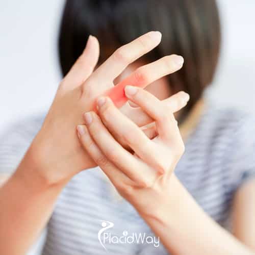 Stem Cells for Autoimmune Diseases: Vietnamese Are Trusting Osaka for Groundbreaking Treatment